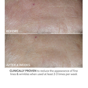 Dr. Dennis Gross Advanced Retinol + Ferulic Perfekt dosiertes Retinol Universal 0,2 %